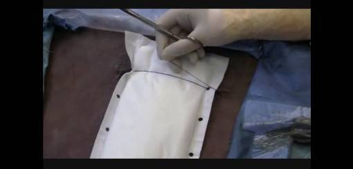 KRUUSE | Equine Stent